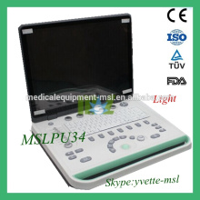 MSLPU34M Cheap Full digital imaging technology ultrasound scanner portable ultrasound machine price for sale